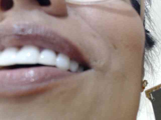 Melisager webcam