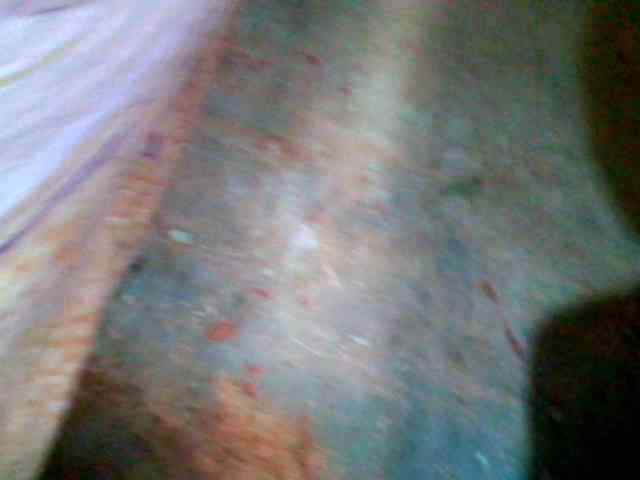 Allycha1 Allycha1