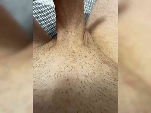 Mi9