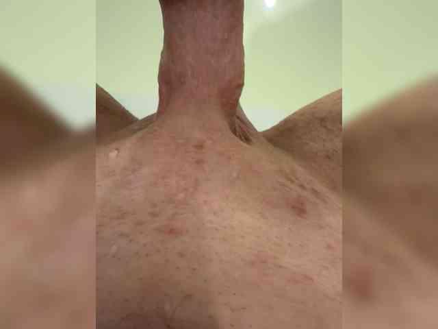 Mi9