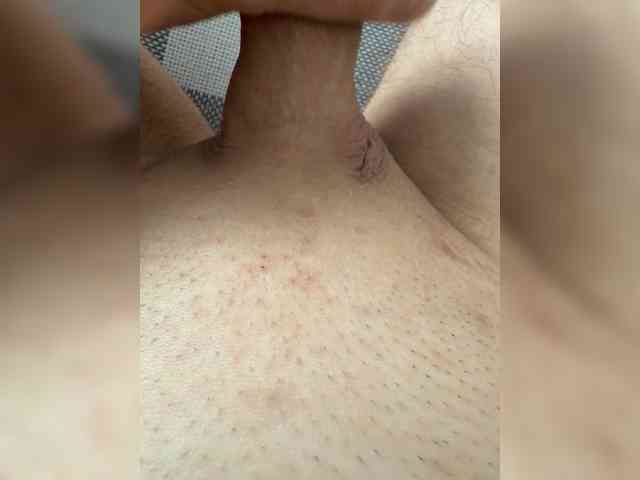 Mi9