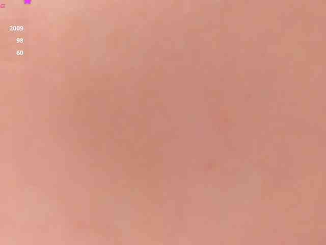 Anyssia