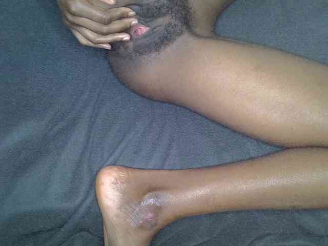 Cynne