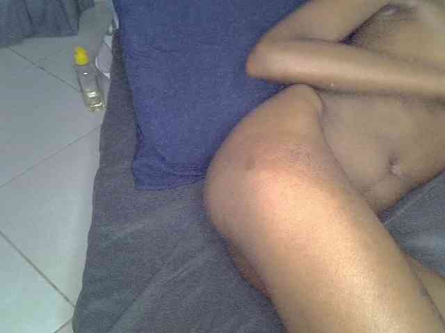 Cynne