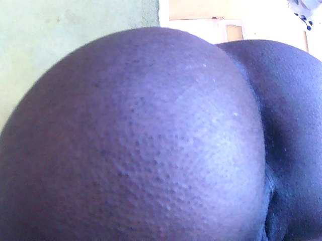 Anal-84