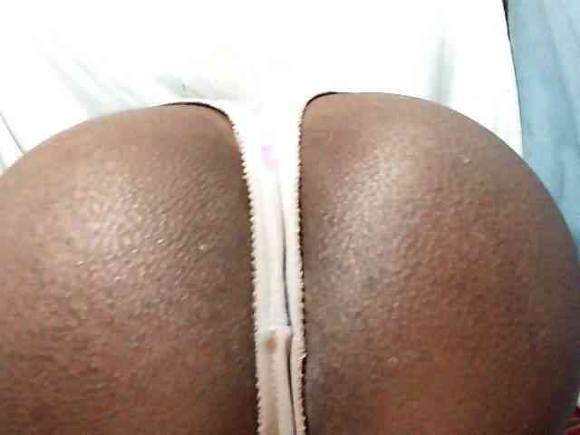 Anal-84