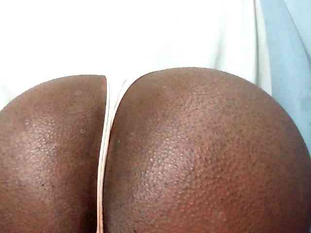 Anal-84