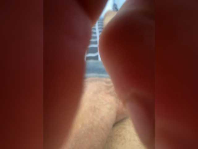 Overback