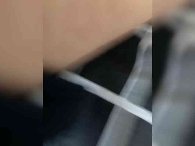 overback