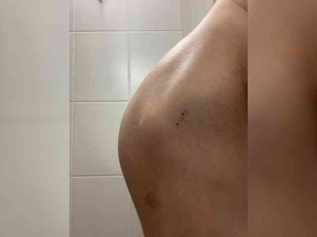 overback