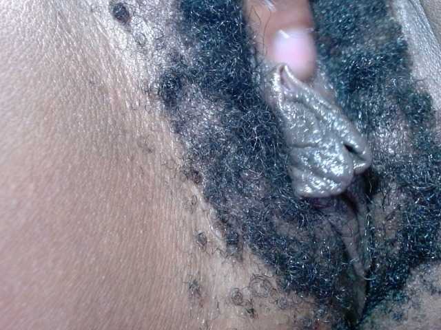 Skinybitchx