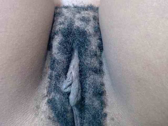 Skinybitchx