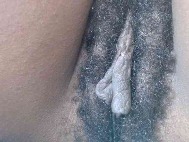 Skinybitchx