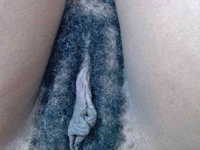 Skinybitchx