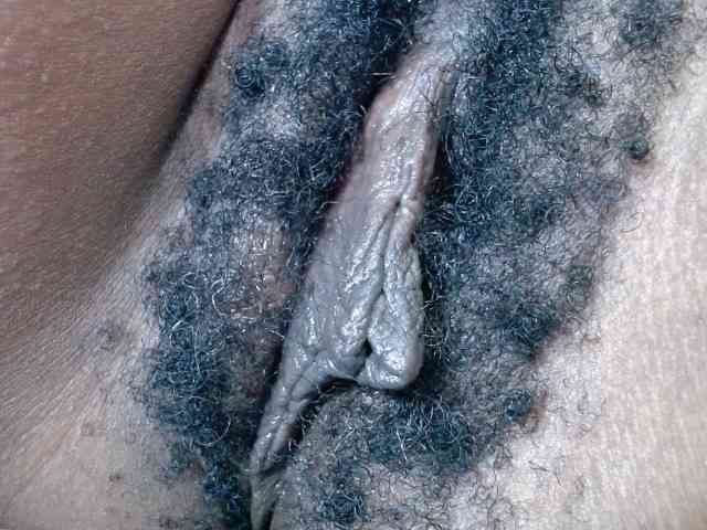 Skinybitchx