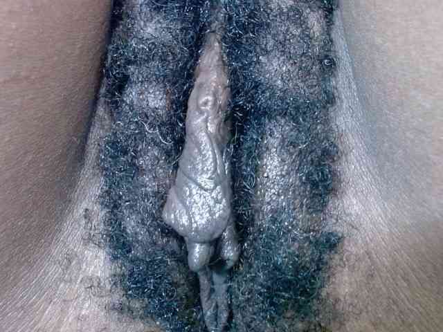 Skinybitchx Skinybitchx