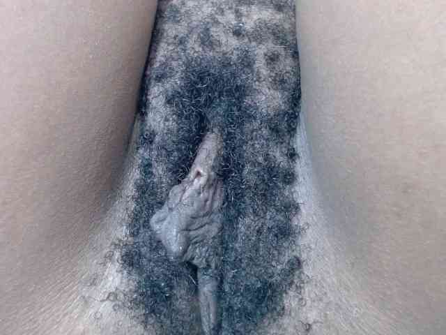 Skinybitchx
