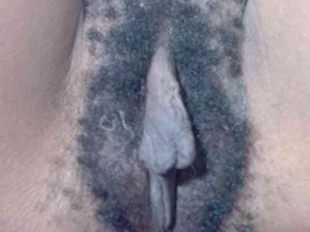 Skinybitchx