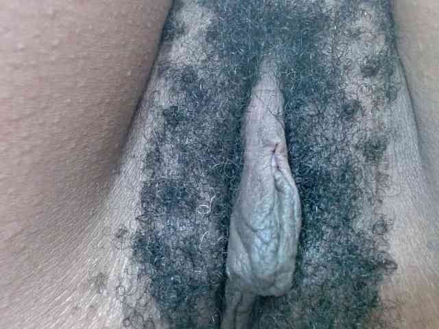 Skinybitchx