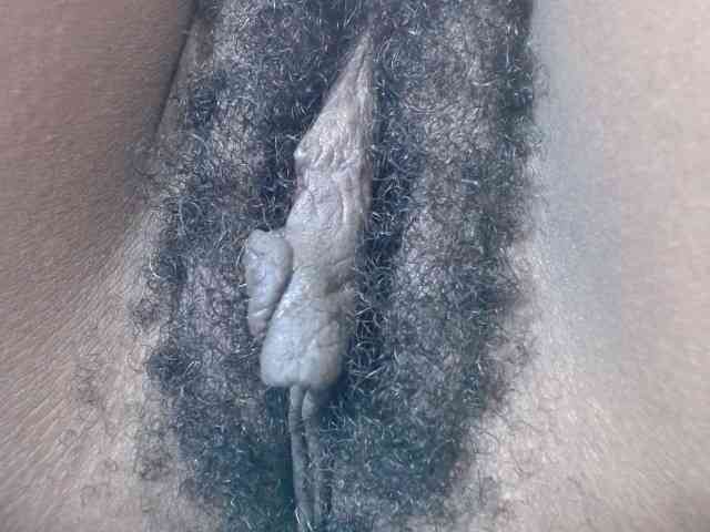 Skinybitchx