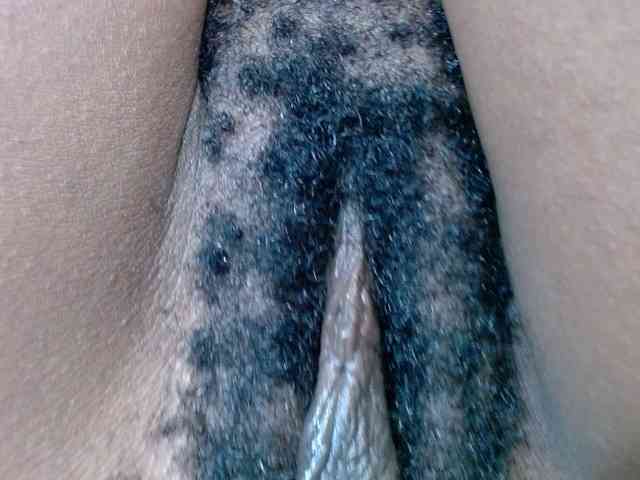 Skinybitchx
