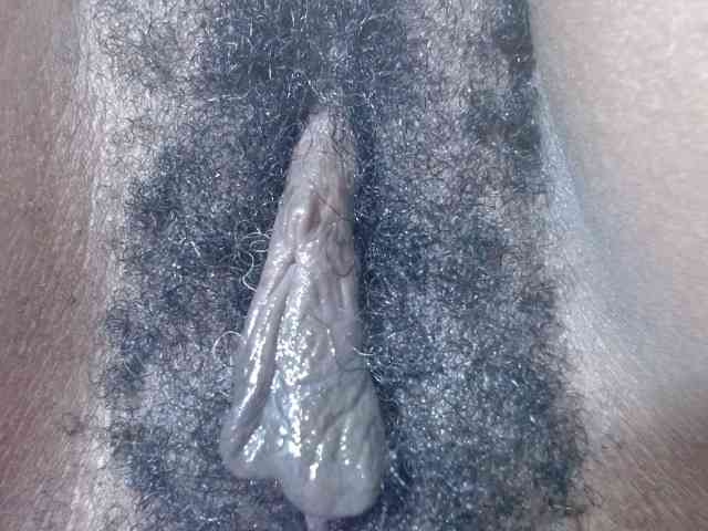 Skinybitchx