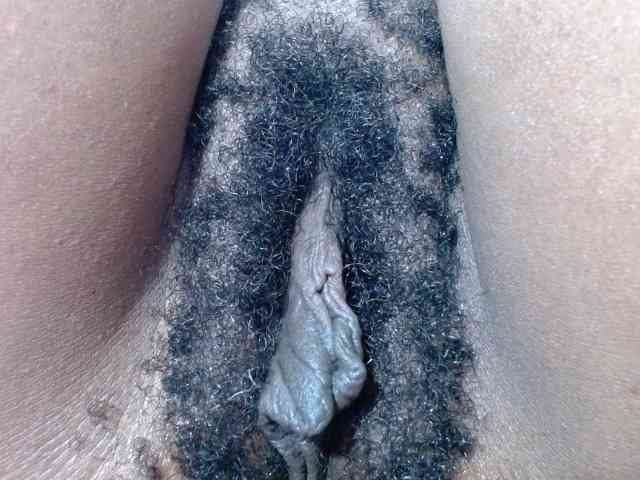 Skinybitchx