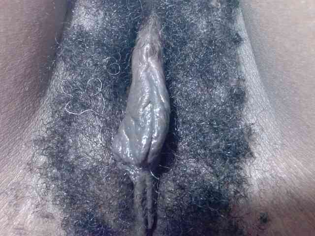 Skinybitchx