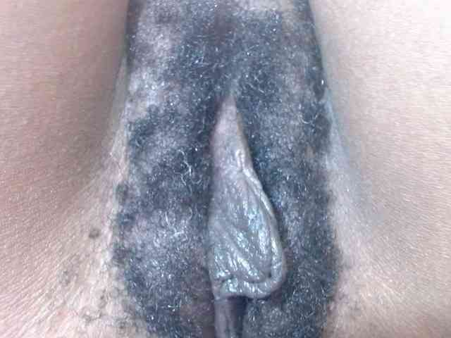 Skinybitchx