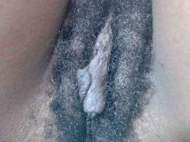 Skinybitchx