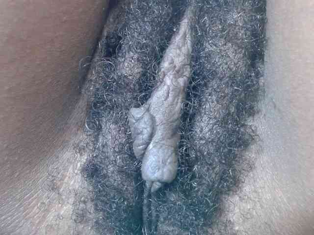 Skinybitchx