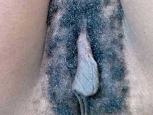 Skinybitchx Skinybitchx