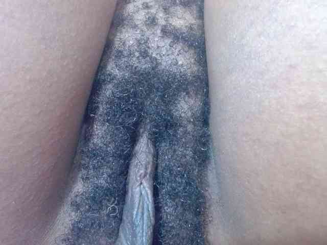 Skinybitchx