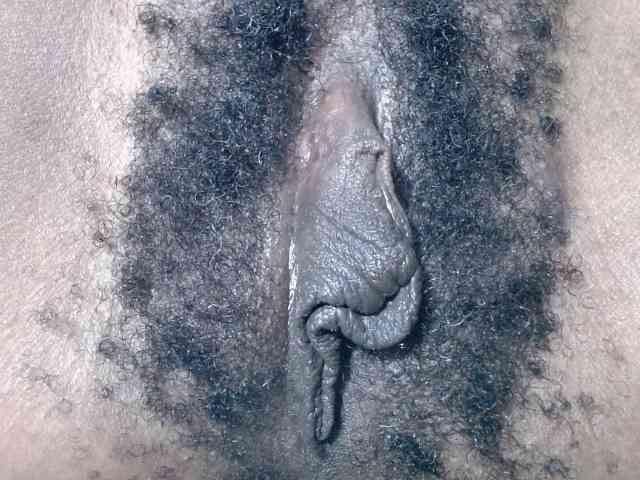 Skinybitchx