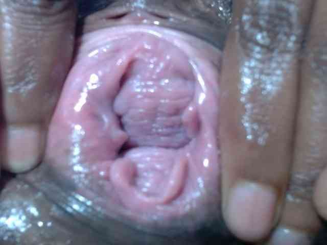 Skinybitchx Skinybitchx