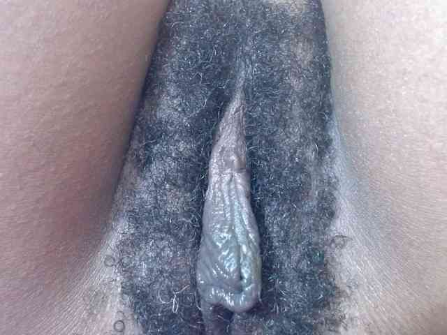 Skinybitchx