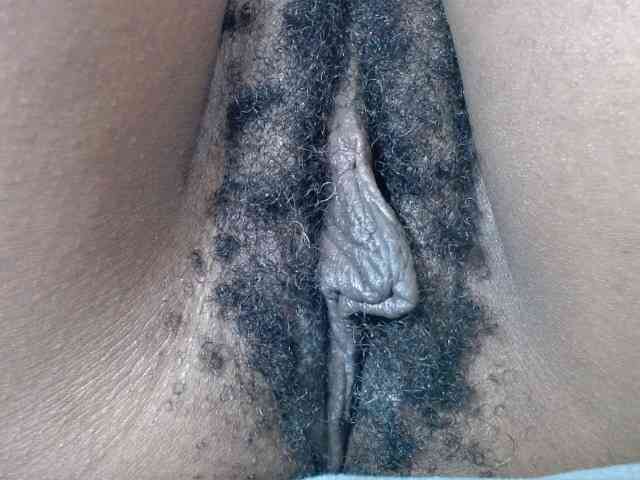 Skinybitchx