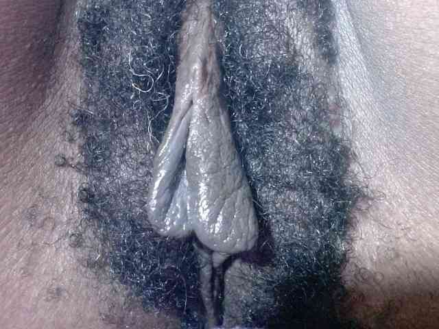 Skinybitchx