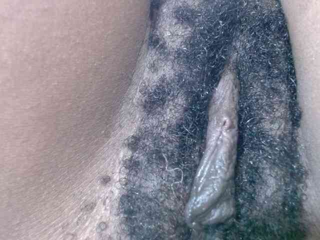 Skinybitchx