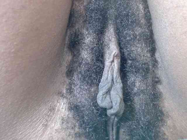 Skinybitchx