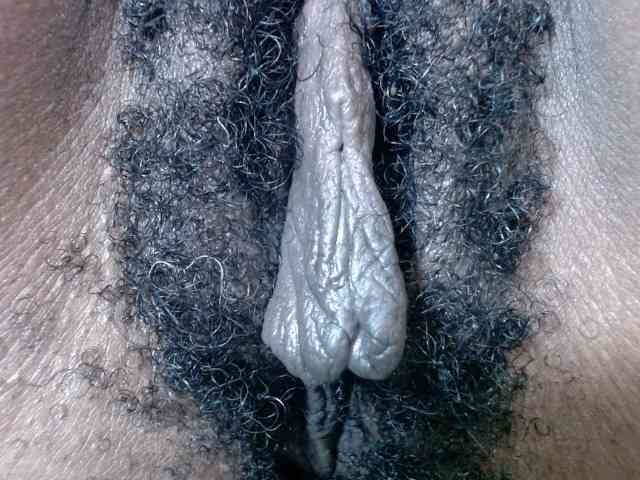 Skinybitchx
