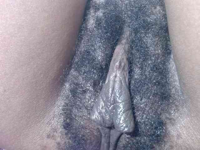 Skinybitchx