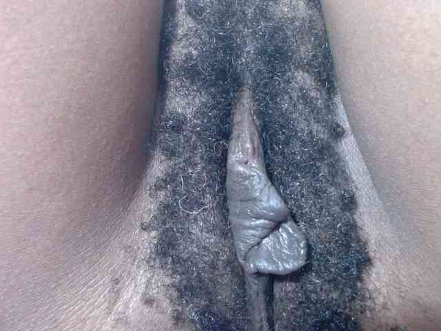 Skinybitchx