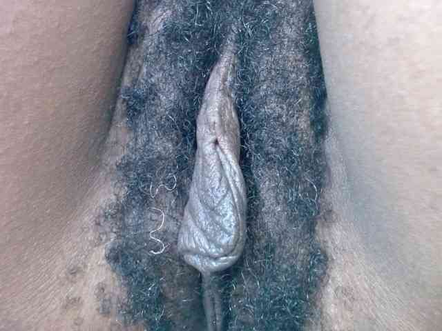 Skinybitchx