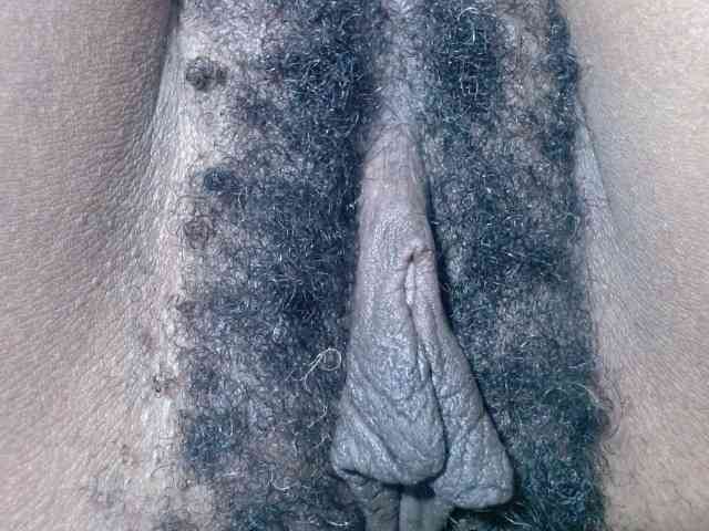 Skinybitchx