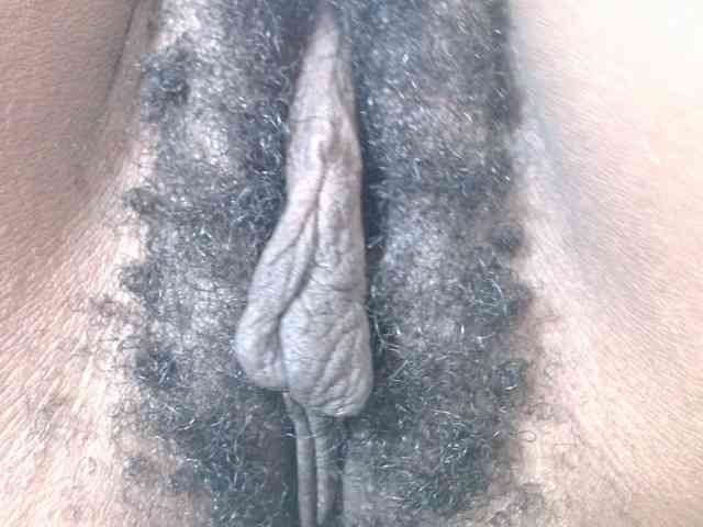 Skinybitchx