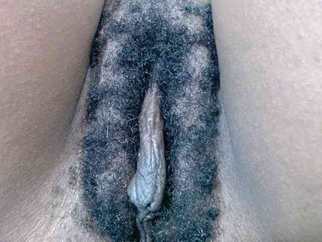 Skinybitchx