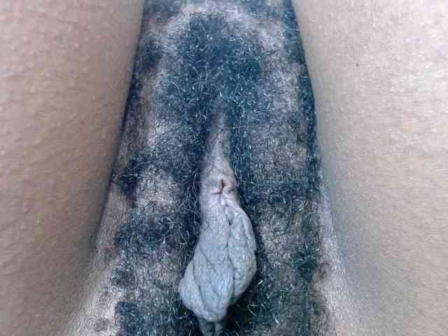 Skinybitchx