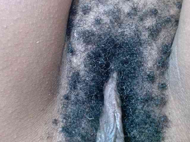 Skinybitchx