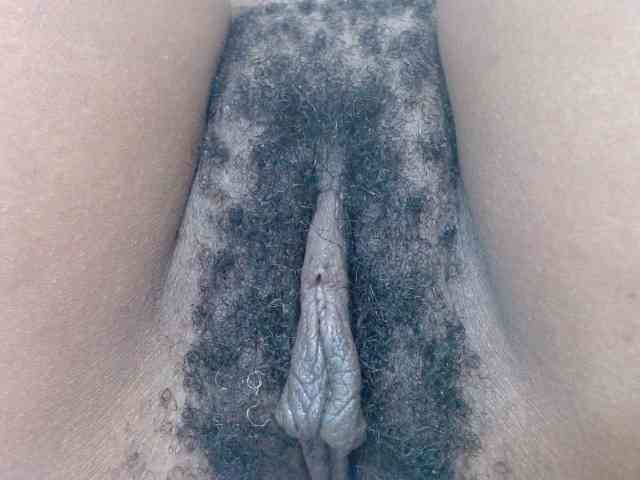 Skinybitchx